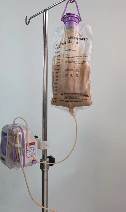 enteral feeding pump